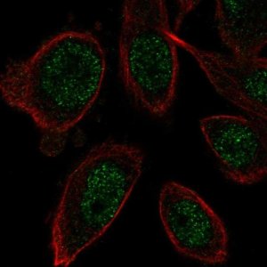 Anti-ZNF664 antibody produced in rabbit 
