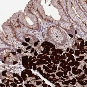 Anti-ZNF665 antibody produced in rabbit 