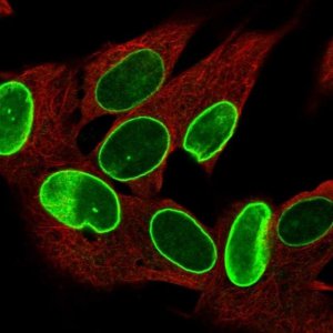 Anti-ZNF665 antibody produced in rabbit 