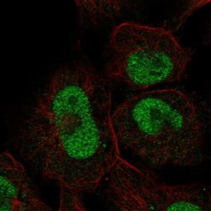 Anti-ZNF667 antibody produced in rabbit HPA030731-100UL