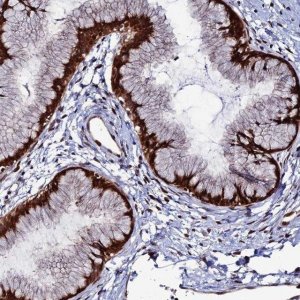 Anti-ZNF668 antibody produced in rabbit 