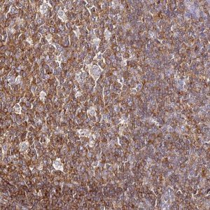 Anti-ZNF671 antibody produced in rabbit 