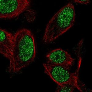 Anti-ZNF672 antibody produced in rabbit 