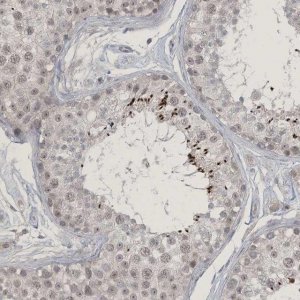 Anti-ZNF674 antibody produced in rabbit 