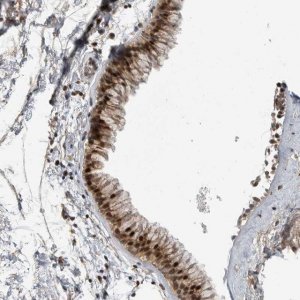 Anti-ZNF677 antibody produced in rabbit HPA024796-100UL