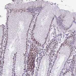Anti-ZNF682 antibody produced in rabbit 