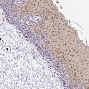 Anti-ZNF684 antibody produced in rabbit 