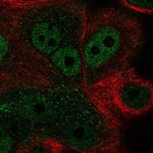 Anti-ZNF687 antibody produced in rabbit 