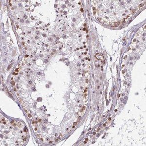 Anti-ZNF689 antibody produced in rabbit 