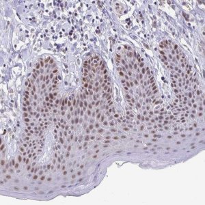 Anti-ZNF691 antibody produced in rabbit 