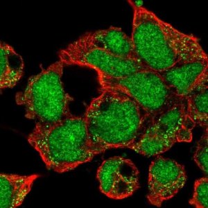 Anti-ZNF691 antibody produced in rabbit 