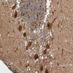 Anti-ZNF695 antibody produced in rabbit HPA024743-100UL