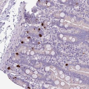 Anti-ZNF697 antibody produced in rabbit 
