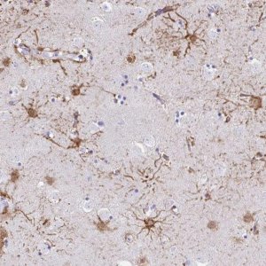 Anti-ZNF699 antibody produced in rabbit 