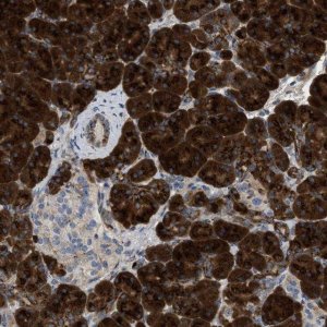 Anti-ZNF70 antibody produced in rabbit 