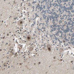 Anti-ZNF701 antibody produced in rabbit HPA005532-100UL