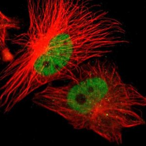 Anti-ZNF701 antibody produced in rabbit HPA005532-100UL