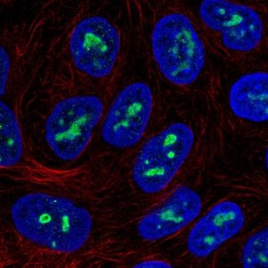 Anti-ZNF713 antibody produced in rabbit 