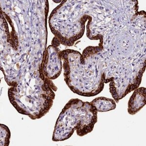 Anti-ZNF720 antibody produced in rabbit 