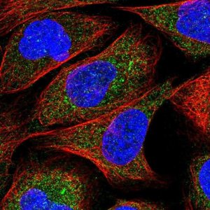 Anti-ZNF720 antibody produced in rabbit 