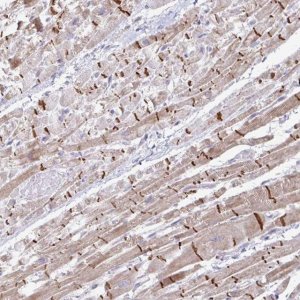 Anti-ZNF736 antibody produced in rabbit 