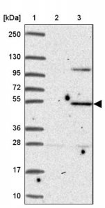 Anti-ZNF736 antibody produced in rabbit 