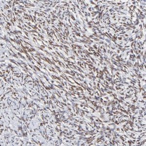 Anti-ZNF74 antibody produced in rabbit 