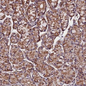 Anti-ZNF749 antibody produced in rabbit 
