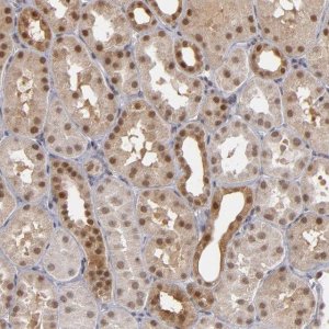 Anti-ZNF75A antibody produced in rabbit 