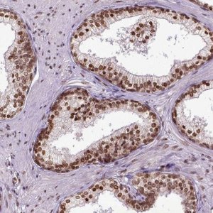 Anti-ZNF75D antibody produced in rabbit 