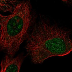 Anti-ZNF771 antibody produced in rabbit 