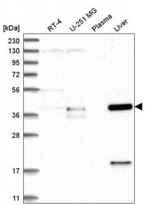 Anti-ZNF771 antibody produced in rabbit 