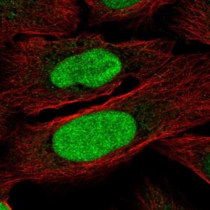 Anti-ZNF776 antibody produced in rabbit 