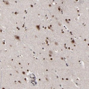 Anti-ZNF777 antibody produced in rabbit 