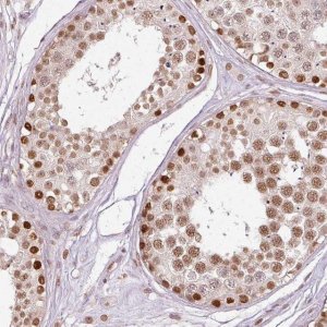 Anti-ZNF778 antibody produced in rabbit HPA052057-100UL