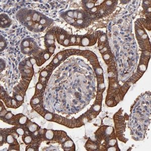 Anti-ZNF780B antibody produced in rabbit 