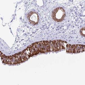Anti-ZNF781 antibody produced in rabbit 