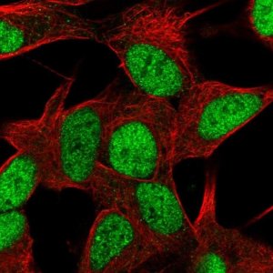Anti-ZNF781 antibody produced in rabbit 