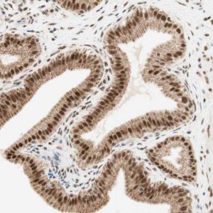 Anti-ZNF782 antibody produced in rabbit 