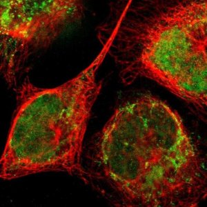 Anti-ZNF782 antibody produced in rabbit 
