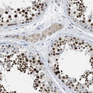 Anti-ZNF783 antibody produced in rabbit 