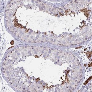 Anti-ZNF784 antibody produced in rabbit 