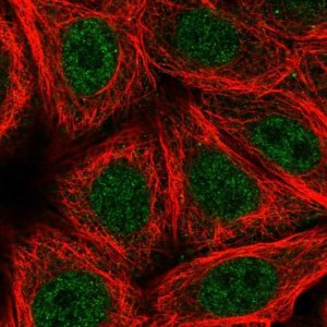 Anti-ZNF789 antibody produced in rabbit 