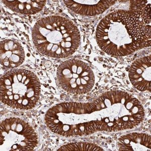 Anti-ZNF790 antibody produced in rabbit 
