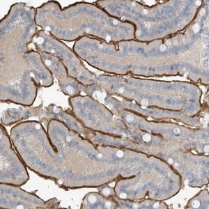 Anti-ZNF793 antibody produced in rabbit 