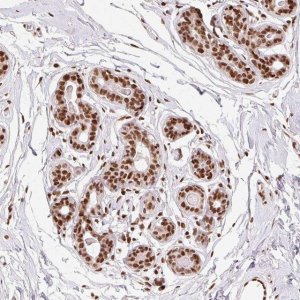 Anti-ZNF80 antibody produced in rabbit 