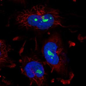 Anti-ZNF800 antibody produced in rabbit HPA052194-100UL