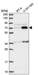 Anti-ZNF800 antibody produced in rabbit HPA052194-100UL