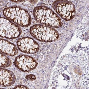 Anti-ZNF81 antibody produced in rabbit 