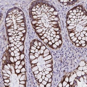 Anti-ZNF813 antibody produced in rabbit 
